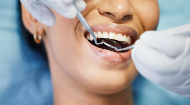 Best Dental Abscess Treatment in Washington, IA