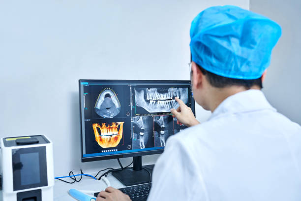 Best Emergency Wisdom Tooth Extraction in Washington, IA