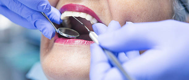Best Emergency Root Canal Therapy in Washington, IA